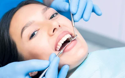 Füllungstherapie  – Moderne Lösungen für Ihre Zahngesundheit in Bonn